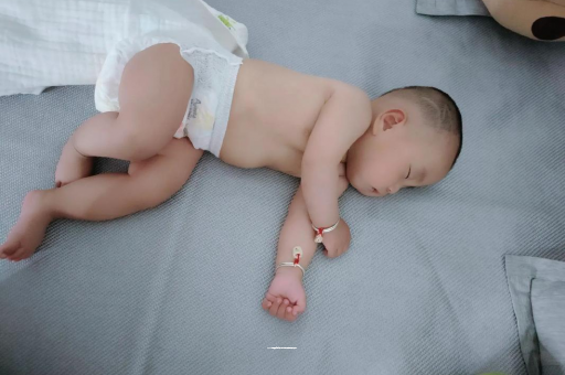 呼和浩特宝宝头上长痱子